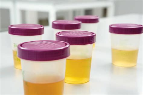 urine test hard|urine tests for peeing.